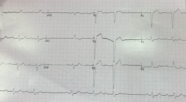Weakness and Dizziness in a 76 Year-old Male