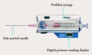 The Stryker Device is a type of hand-held manometer which performs direct measurements of compartment pressures.