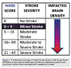 Source: cathlabdigest.com/article/Newly-Demonstrated-Safe-Approach-Rationale-Intravenous-rtPA-Used-Acute-Stroke-Patients-NIHSS