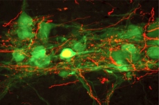 Neuron - Image from Drexel Spinal Cord Research Center