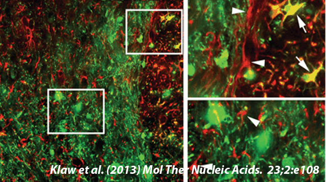 Mol. Ther. Nucleic Acids - Image from Drexel's Spinal Cord Research Center