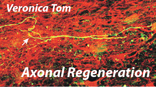 Axonal Regeneration - Veronica Tom Lab