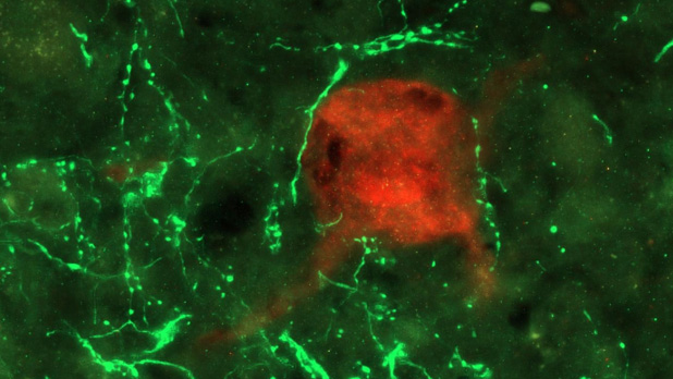 Pseudorabies virus (PRV) positive, phrenic interneuron (red) part of the host spinal phrenic circuit surrounded by green fluorescent protein positive (GFP, green) donor neural progenitor cells (NPCs) after transplantation into the injury site of a spinal cord.