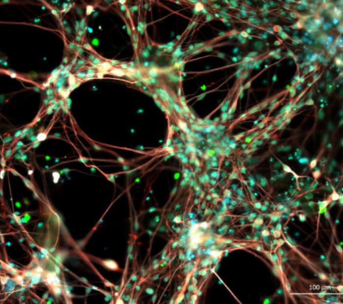 Neuronal Networking Night - Philip Yates