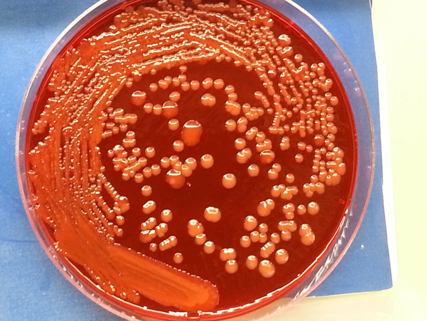 Drexel CAMP Lab: Bacteria on blood agar infusion plate.