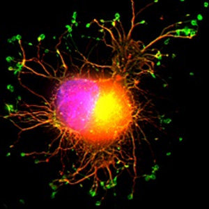 Caspase image from the Alessandro Fatatis Research Laboratory.