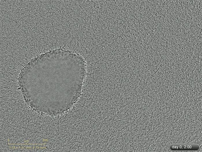 Time-lapse imagery of melanoma spheroid invading into collagen - animated. (Hartsough Lab Research)