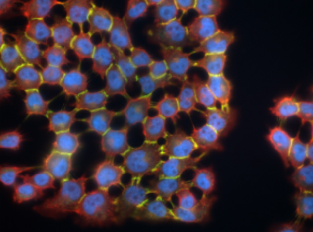 CADM1 expressing melanoma cells. (Hartsough Lab Research)