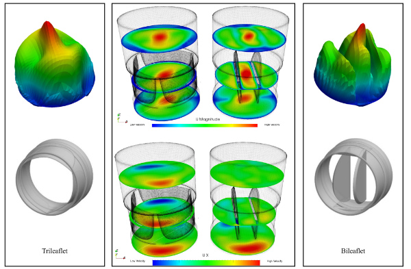 Study of valve-type dependent modulation of generated spiral flow.