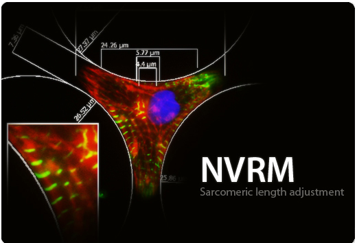 NVRM Sarcomeric length adjustment
