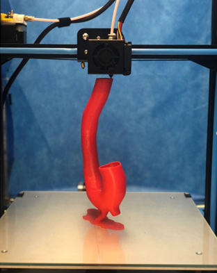 3D-printed model of a patient-specific aortic arch.
