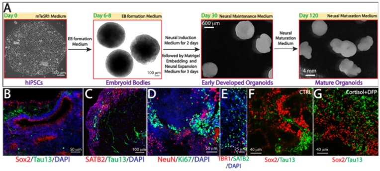 Representative images of human forebrain organoids used in modeling GWI.