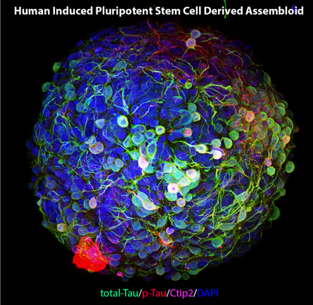 Human induced pluripotent stem cell derived assembloid. Source: Qiang Laboratory