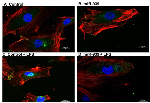 miR-939 reduced the translocation of functional NFκB to nucleus in response to LPS stimulation