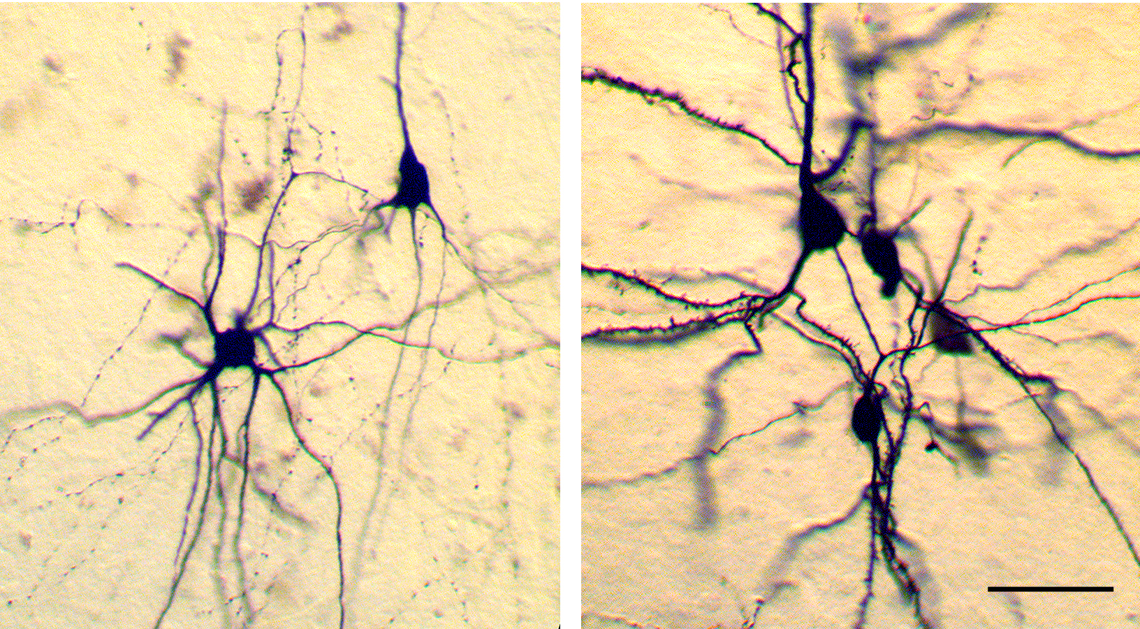 Biocytin-labeled interneurons and pyramidal neurons.
