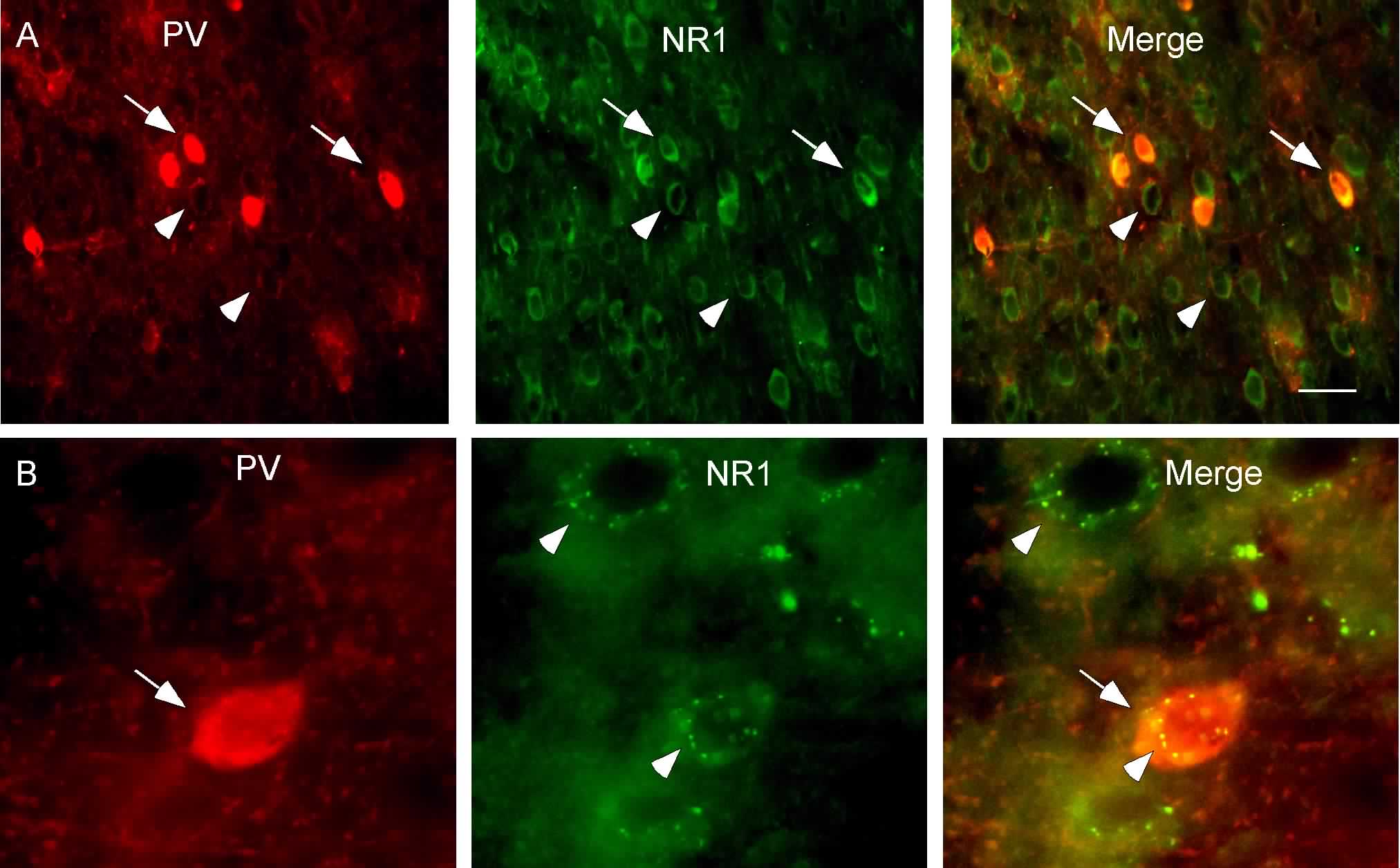 Double labeling of PV and NR1 subunits in the mPFC. PV, localized mainly in the fast-spiking interneurons in the neocortex, was labeled with Texas-Red (red) while NR1 was stained with FITC (green).