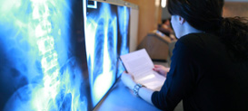 Medical student reviewing x-ray images at a hospital.