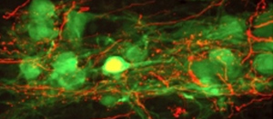 Neuron. Image from Drexel Spinal Cord Research Center