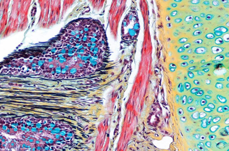 Drexel Histotechnology program image - Movat's Pentachrome Stain, Bronchus.
