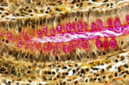 Drexel Histotechnology program image - Sialomucin Magenta Stain, Colon.