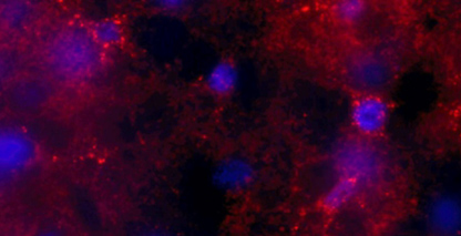 Chemogenetically activated astrocytes in the nucleus accumbens.