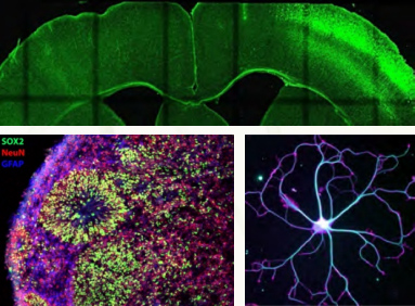 Clockwise from top: cortical section, hippocampal neuron, cerebral organoid.