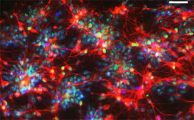 Immunostaining of hiPSC-derived neurons (from veterans with Gulf War Illness) for neuronal markers. (Liang Qiang and Peter W. Baas)