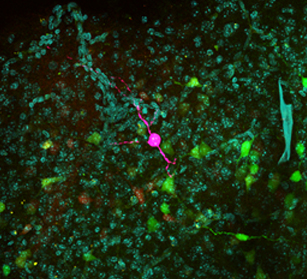 Patched Shox2 interneuron (pink) from a neonatal triple transgenic mouse.