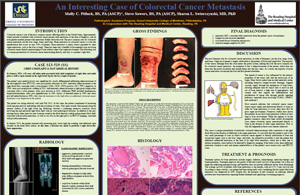 Pathologists' Assistant Research: An Interesting Case of Colorectal Cancer Metastasis