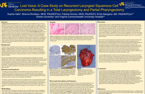 Lost Voice: A Case Study on Recurrent Laryngeal Squamous Cell Carcinoma Resulting in a Total Laryngectomy and Partial Pharyngectomy