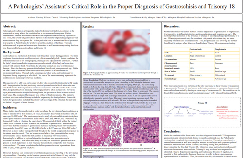 A Pathologists' Assistant's Critical Role in the Proper Diagnosis of Gastroschisis and Trisomy 18
