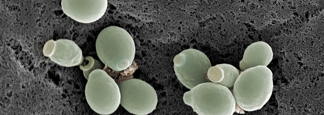 Yeast cells, Candida albicans, SEM