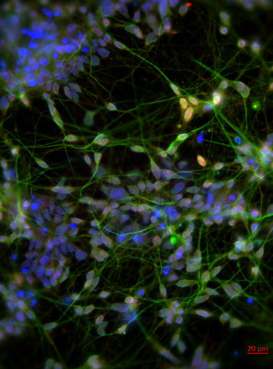 Human induced pluripotent stem cells (hiPSCs) were differentiated into mature neurons in order to study how Gulf War neurotoxicants alter microtubule behaviors in human neurons.