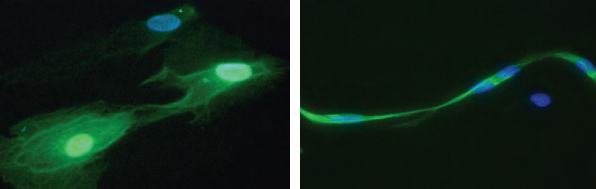 Images of neurons differentiating in culture show how rapamycin (right) enhances this process versus control.