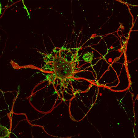 Confocal image of a cortical neuron expressing the herpesvirus transport protein US9 fused to a green fluorescent protein.