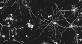An image of DRG Neurons from the neuroscience program at Drexel University College of Medicine.