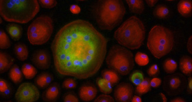 Gaskill Lab: Fluorescent image of primary human macrophages infected with HIVADA in the presence of 2 x 10-5 M dopamine stained for nuclei (blue), actin (Texas Red) and the HIV capsid protein p24 (Green).