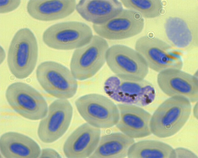Haemoproteus parasites infect one of the red blood cells shown in this sample taken from a bird in Malawi. Credit: Jacob Mertes, University of North Dakota