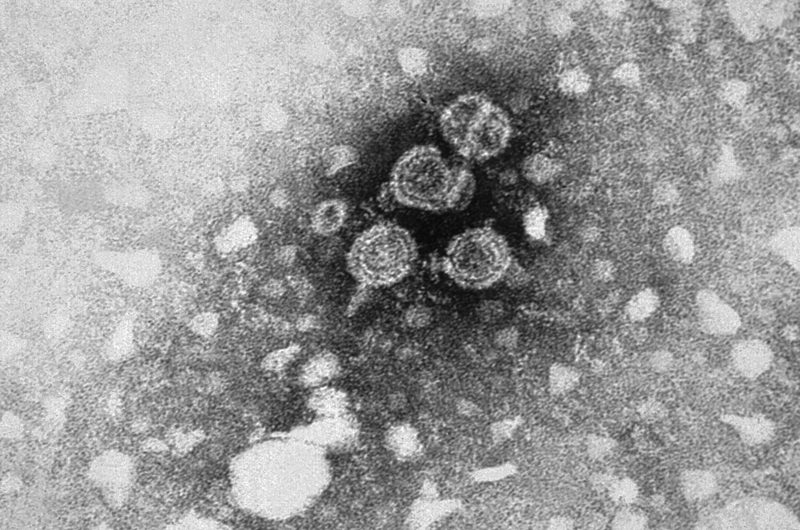 A microscopic image of the Hepatitis B virus.