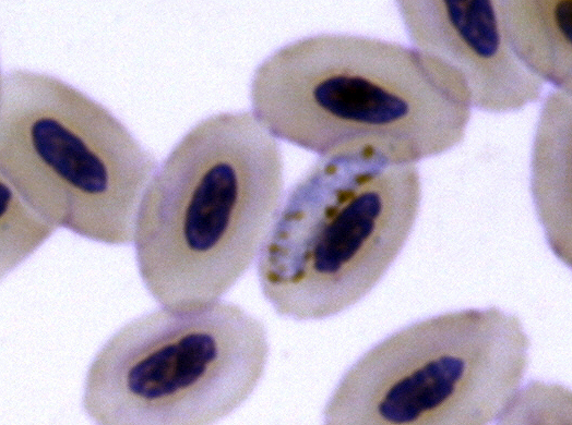 A microscopic image of Haemoproteus parasites