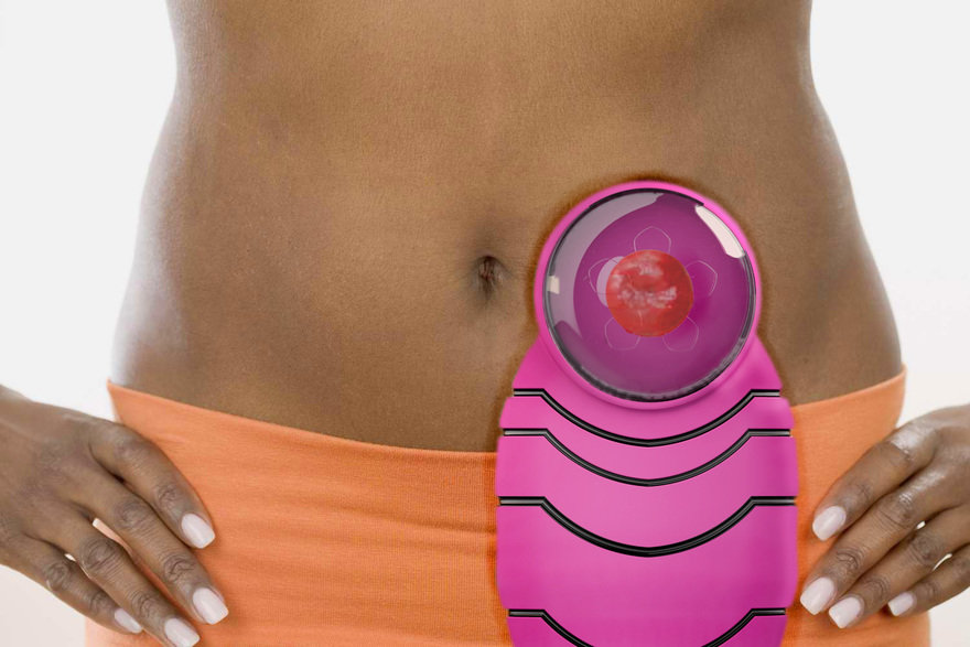 Concept photo for Convatec bag by Henry McGettigan